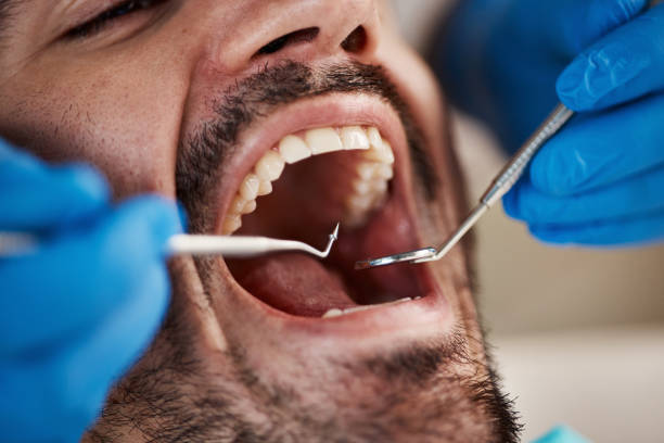 Best Periodontal (Gum) Disease Treatment  in Elwood, IN